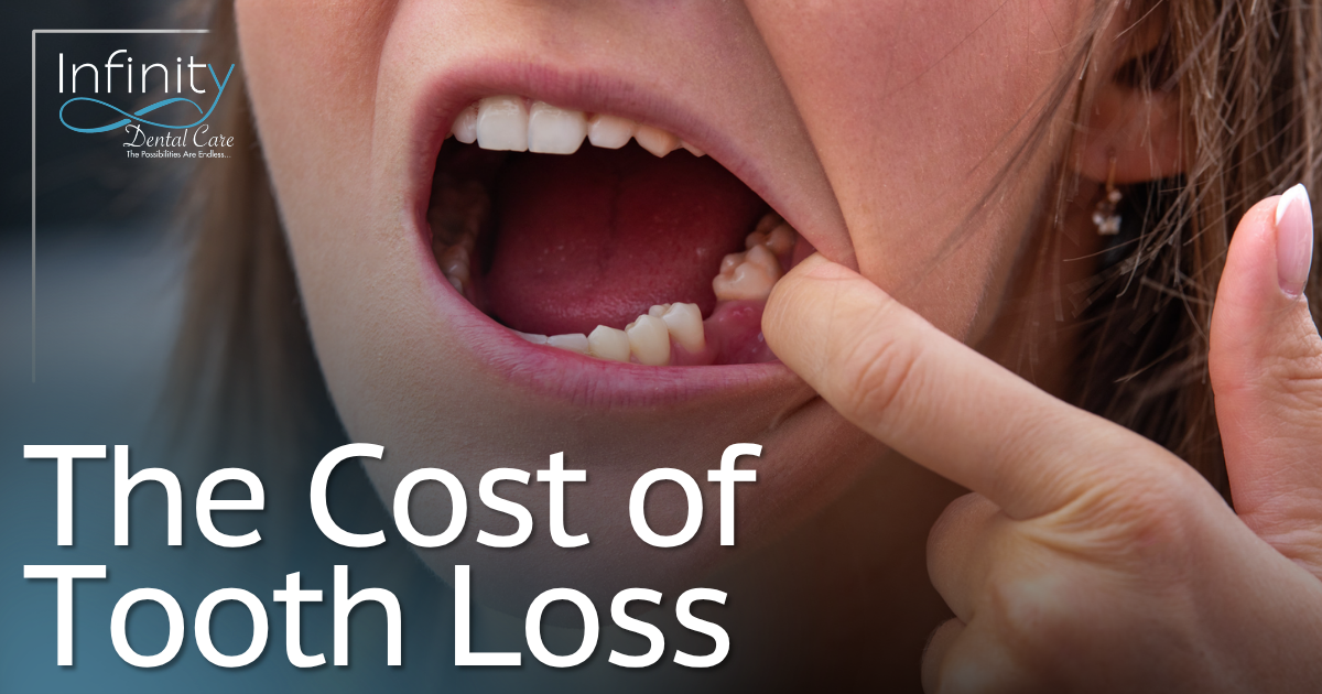 The Cost of Tooth Loss female showing missing tooth
